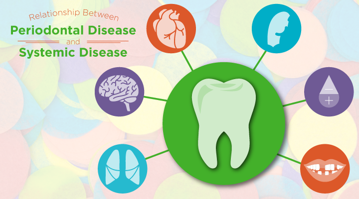 RelationshipBetweenPeriodontalDisease_720x4001.png