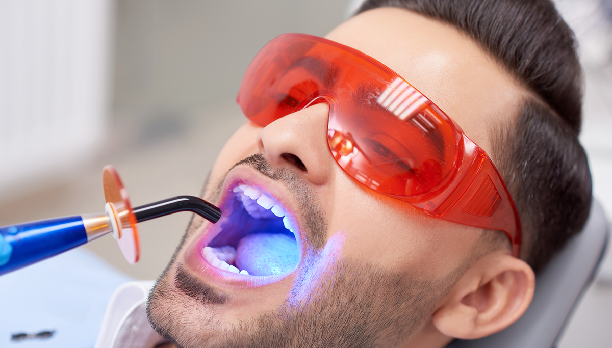 WhatAreDentalSealantsblog.png