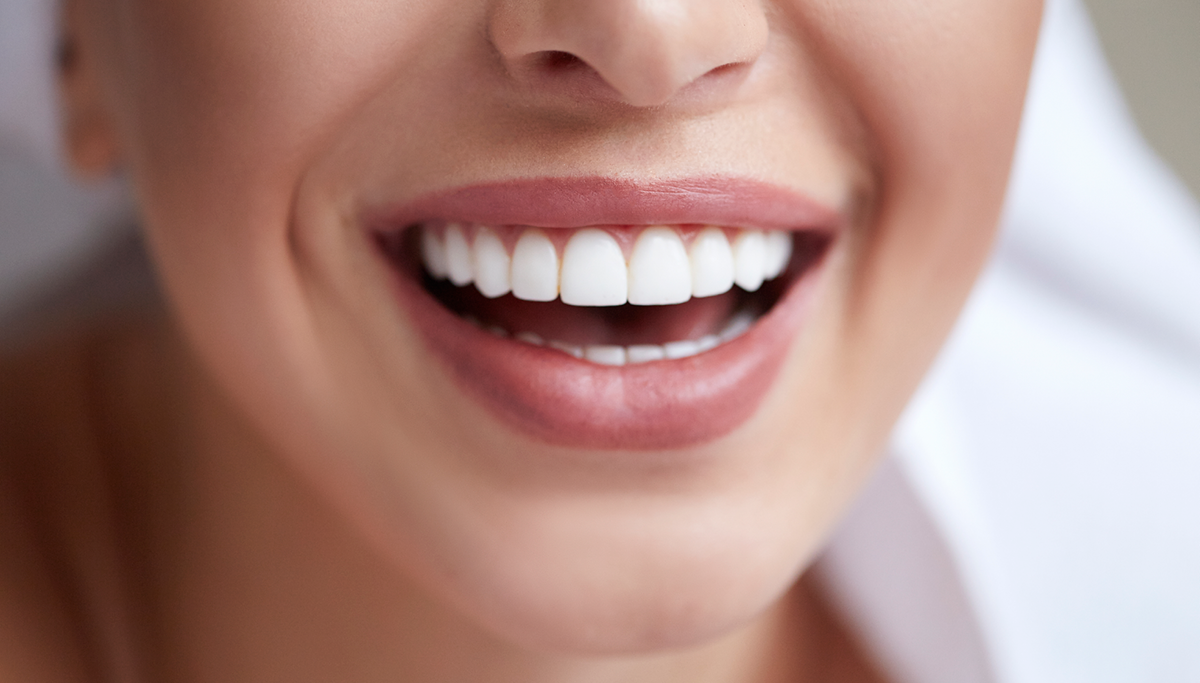 TeethWhiteningDosAndDontsofBrighteningYourSmileblog.png