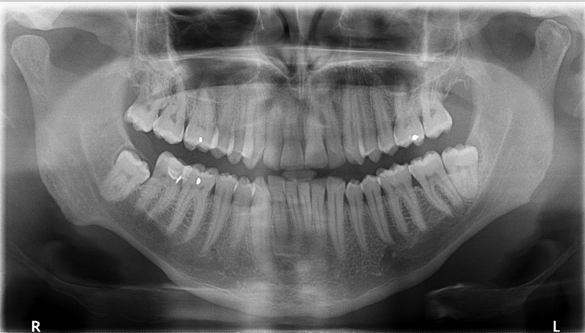 WhatDoesTheFutureOfDentistryLookLikeblog.png