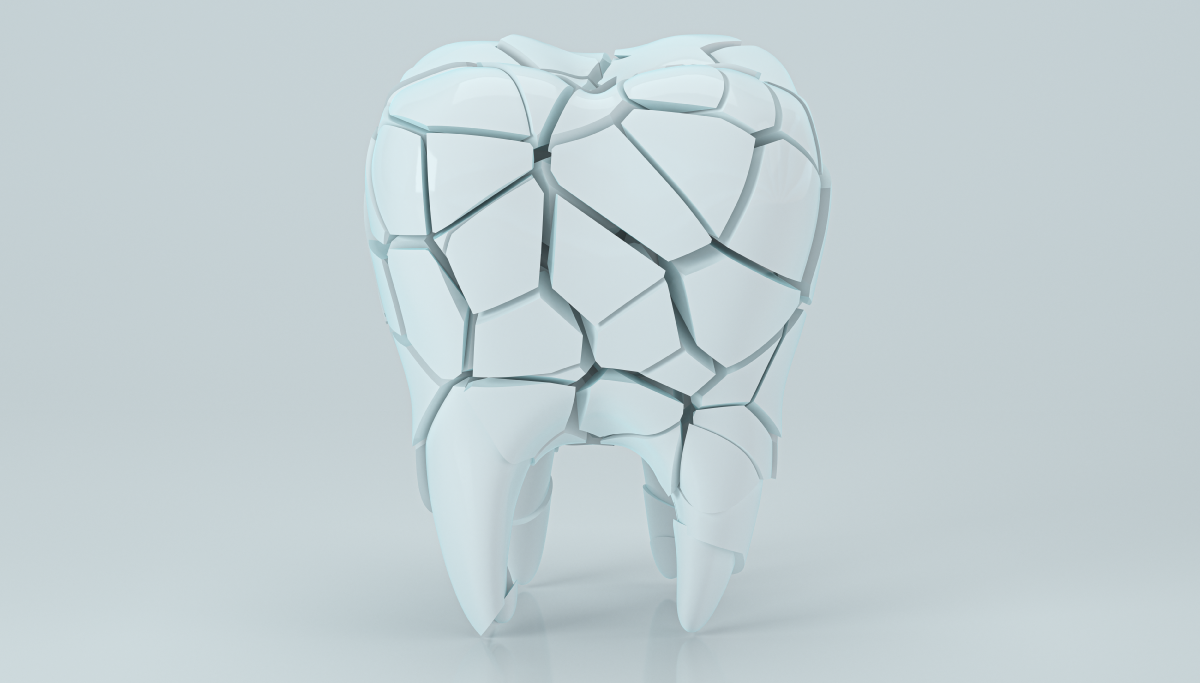 Cracked-Tooth,-Types-of-Tooth-Fractures_1200x683.png